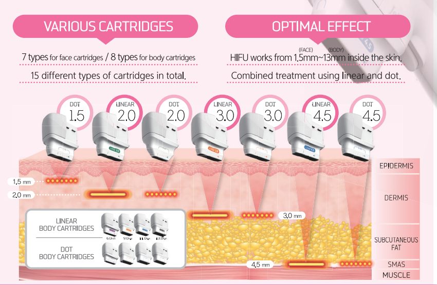 hifu-treatment