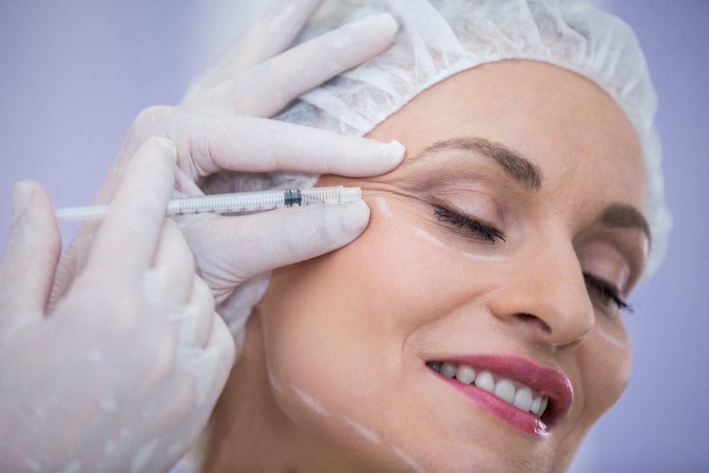 Medic care injecteaza botox in zona laterala a ochiului (laba gastei)