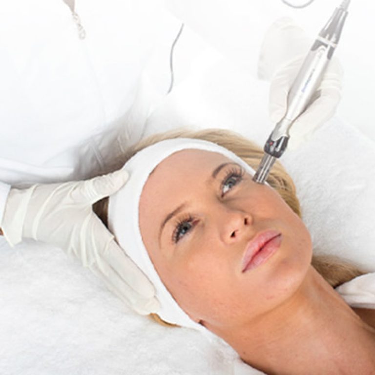 Dermapen Microneedling Refacere-Intinerire Piele