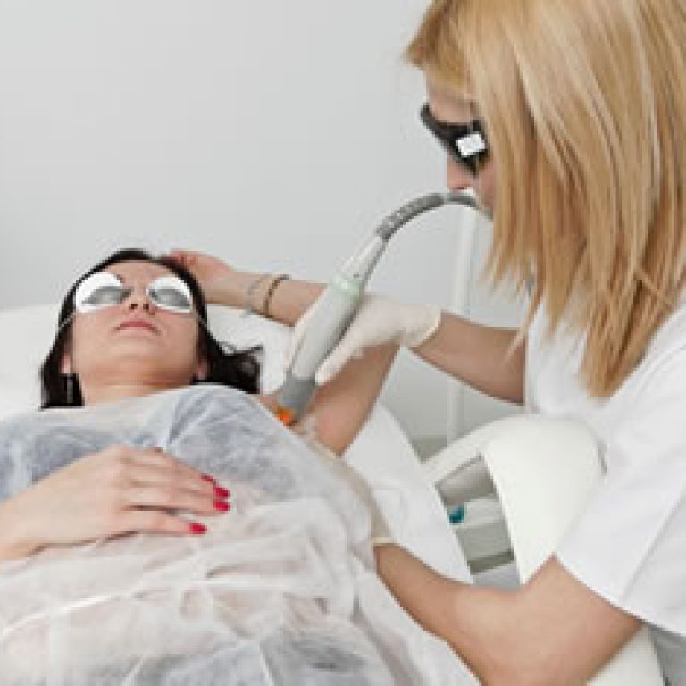 Epilare Laser Dermestetica
