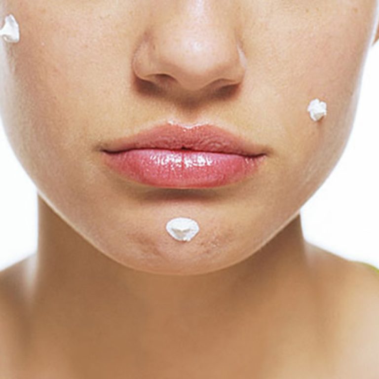 Ingrijire ten acneic / acnee