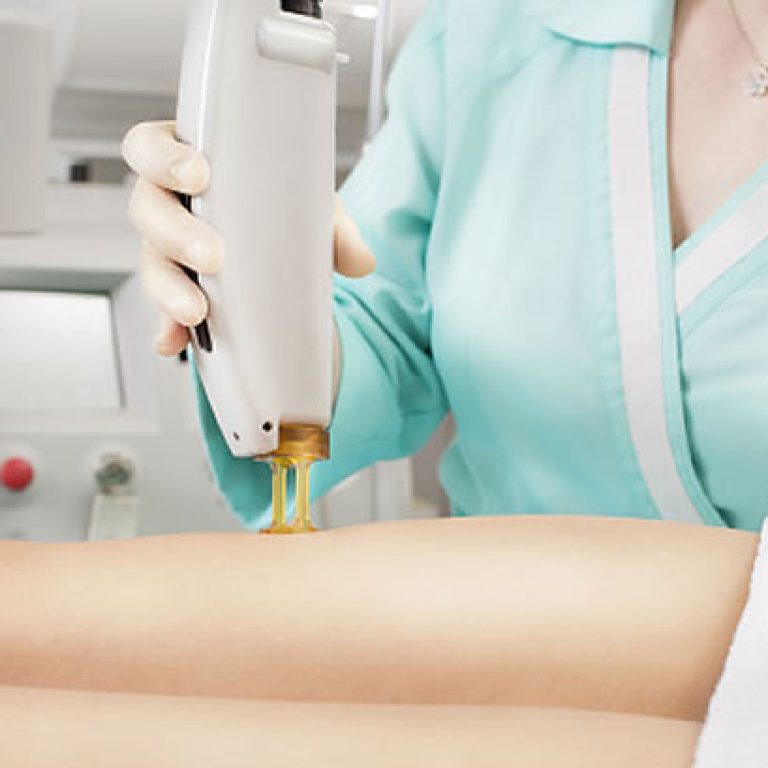 laser-dermatologic