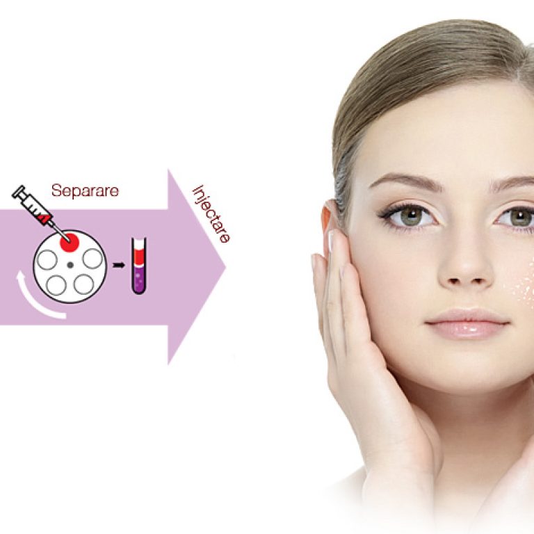 Terapie PRP - Terapia Dracula